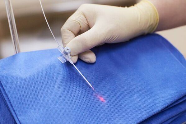 In alcuni casi, la terapia laser viene utilizzata per la prostatite cronica