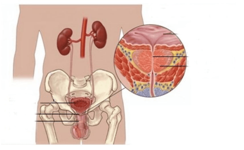 prostatite negli uomini