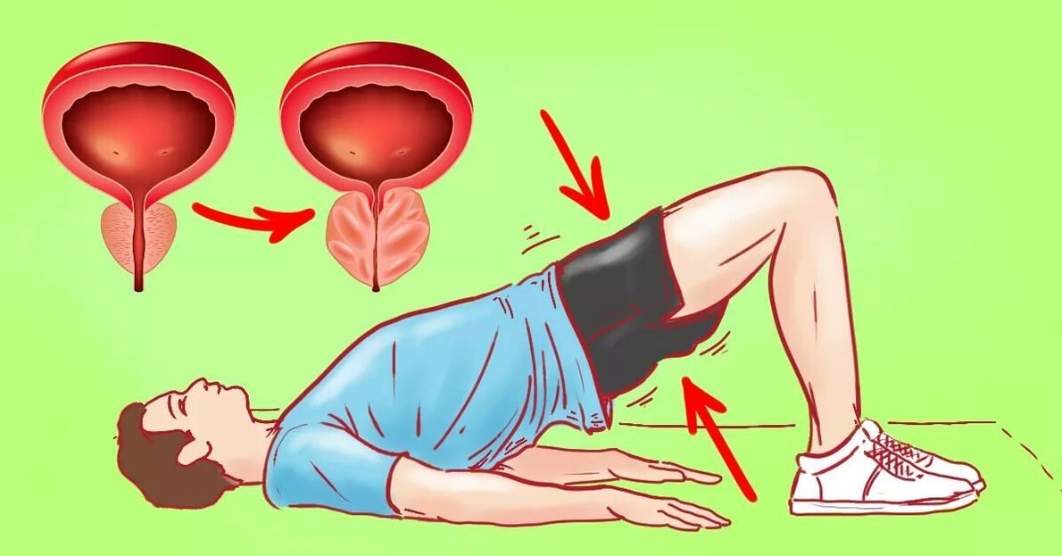 Esercizi per la prostatite